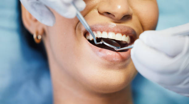 Best Emergency Tooth Extraction in Riverdale, UT