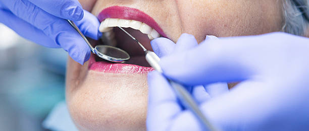 Best Emergency Wisdom Teeth Removal in Riverdale, UT